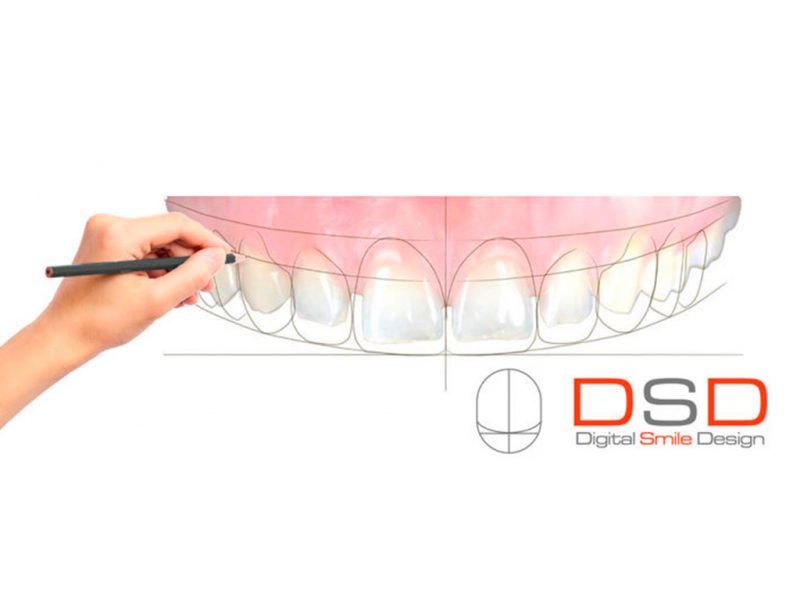 Clínica Dental Pio X, Digital Smile Design